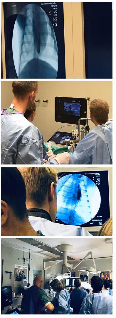 EVTM clinicians working with fluoroscopy and ultrasound in a hybrid training setting