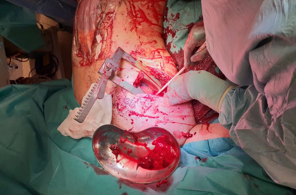 Femoral vascular access in an archived JEVTM clinical case