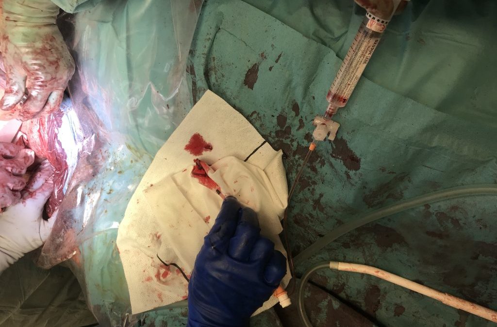 Operative field from an archived JEVTM clinical case